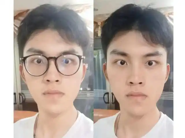 通过近视镜看东西会收缩变形,对近视的人来说,长期戴眼镜不仅会导致