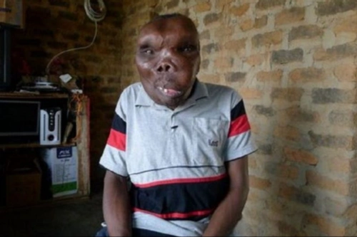 "世界最丑男"的逆袭人生:一夜爆红出道成歌星,娶3任娇妻有8个娃