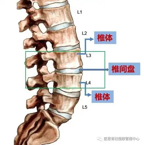 什么是腰椎间盘突出症
