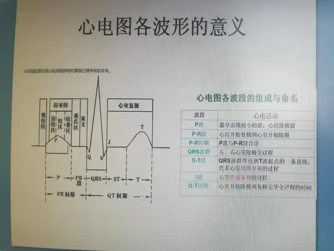 简单学习心电图