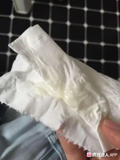 帮忙看看排卵期这个颜色的白带正常吗?嫌恶心的就别打开了!