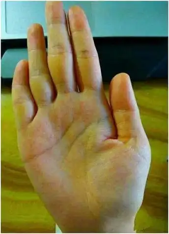 大富大贵手纹分析在线算命,我们每个人的手掌上都是有纹路的而我们的