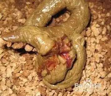 突然便血怎么回事