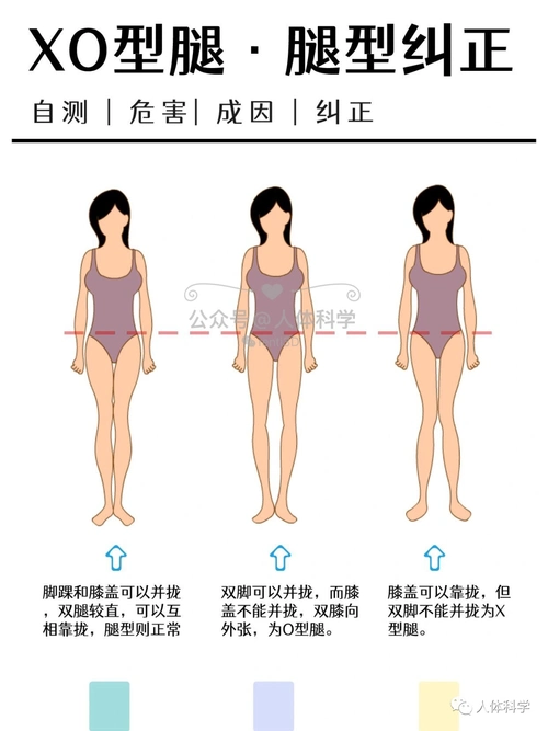 腿型矫正纠正xo型腿提升体态气质