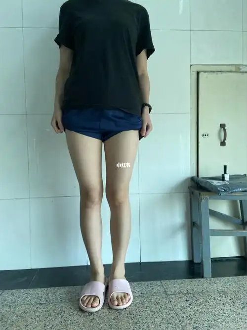 腿型 x o xo 属于哪个_腿型_夏天去哪玩_短裙_改善腿型_生活记录_日常
