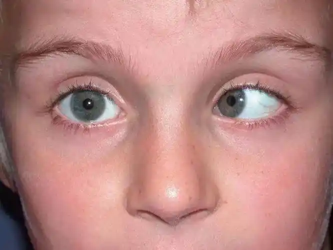 浙江医院三墩院区眼科开设斜弱视专科门诊了