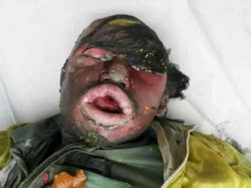 睡觉起来头晕恶心怎么回事早上起来还会头晕