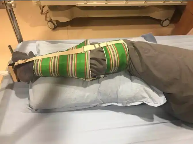 骨牵引的健康宣教