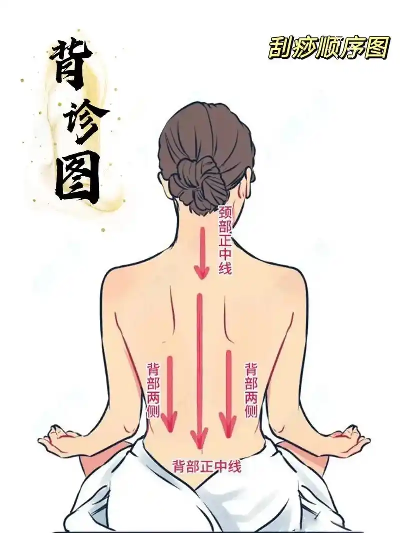 免费刮痧拔罐来了.跟随老中医学习7年的弟子开的理疗工作室 邀 - 抖音