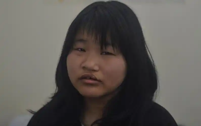 女孩因丑出生被抛弃 如今18岁"美"梦成真:用手术"改脸转运"