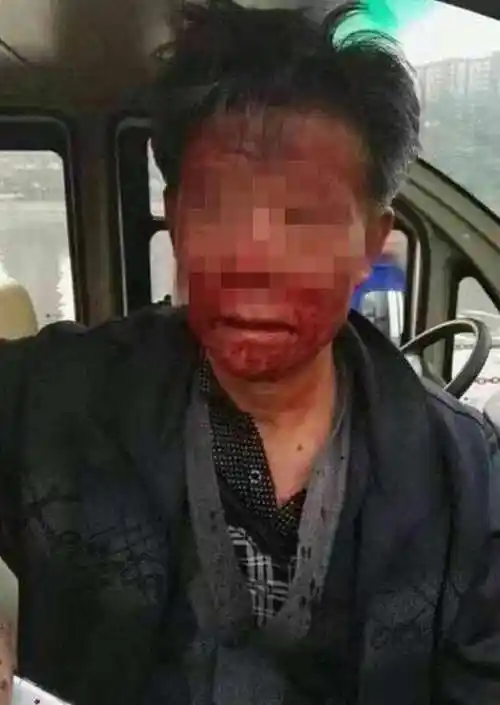 襄汾新闻山西襄汾两名干部公园打架头破血流全程被拍下襄汾新闻襄汾