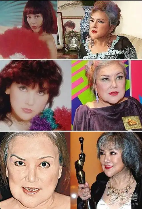 下巴整形失败的女明星:艳星变巫婆