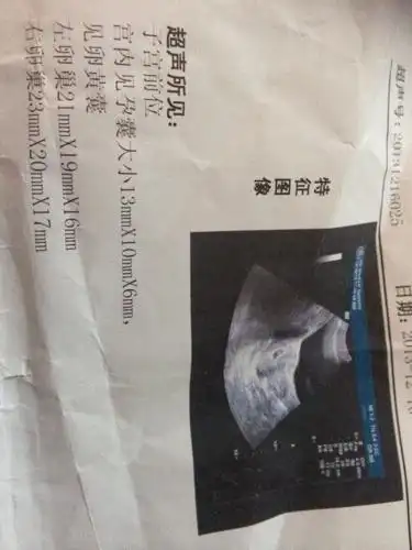 怀孕30天这样正常吗?怀孕15天时做了胸