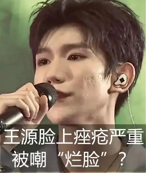 最近看到了王源脸上的痤疮的_圈子-新氧美容整形