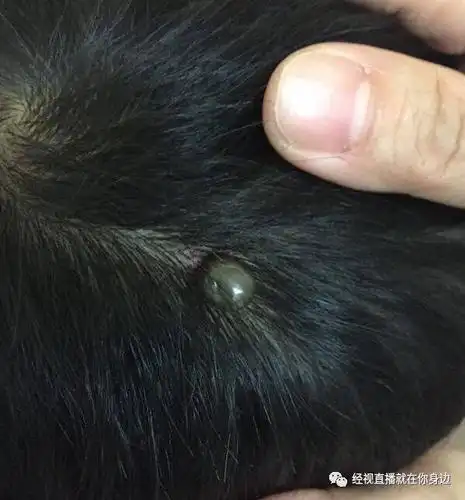 武汉7岁男孩头顶突然出现"黑痣",还越长越大,医生一检查竟发现是