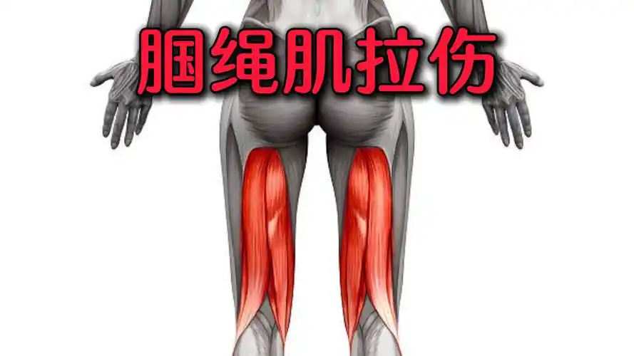 大腿后侧疼痛,可能是腘绳肌拉伤了!