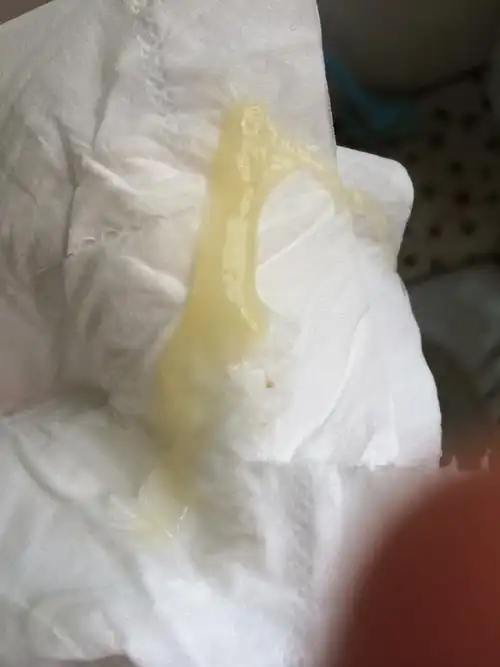 问答 孕晚期cyu    2016-08-06 16:52    浏览  33333  为您推荐