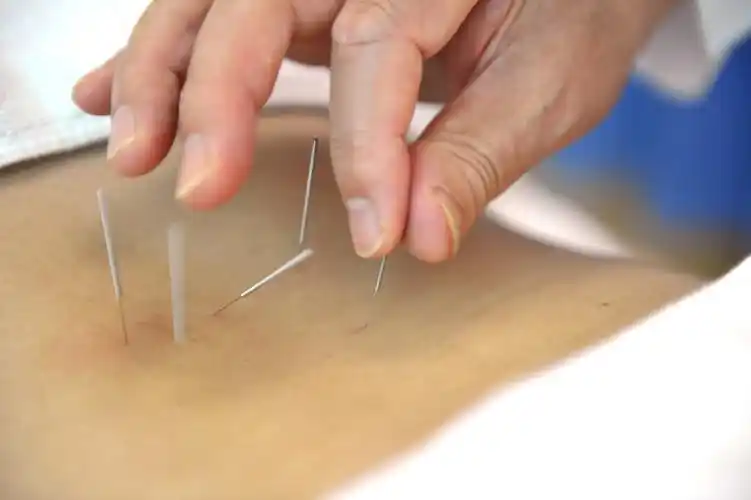 针灸治认知障碍 无忧药物相冲