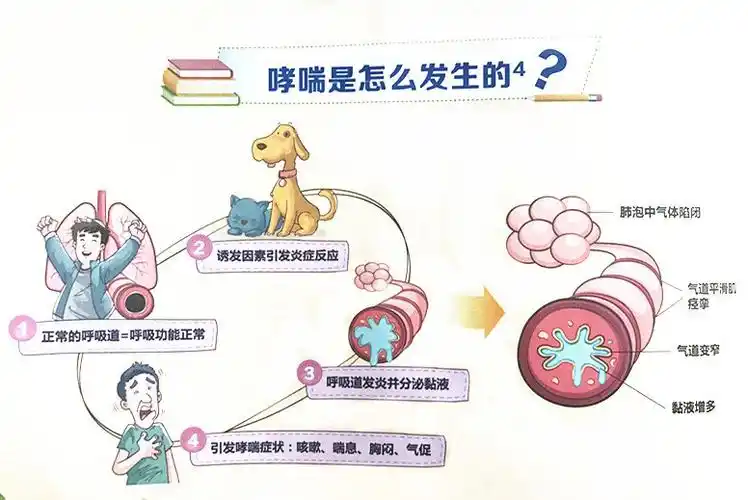 哮喘_介绍_发病原因_症状表现_治疗方式_日常注意事项 - 好大夫在线