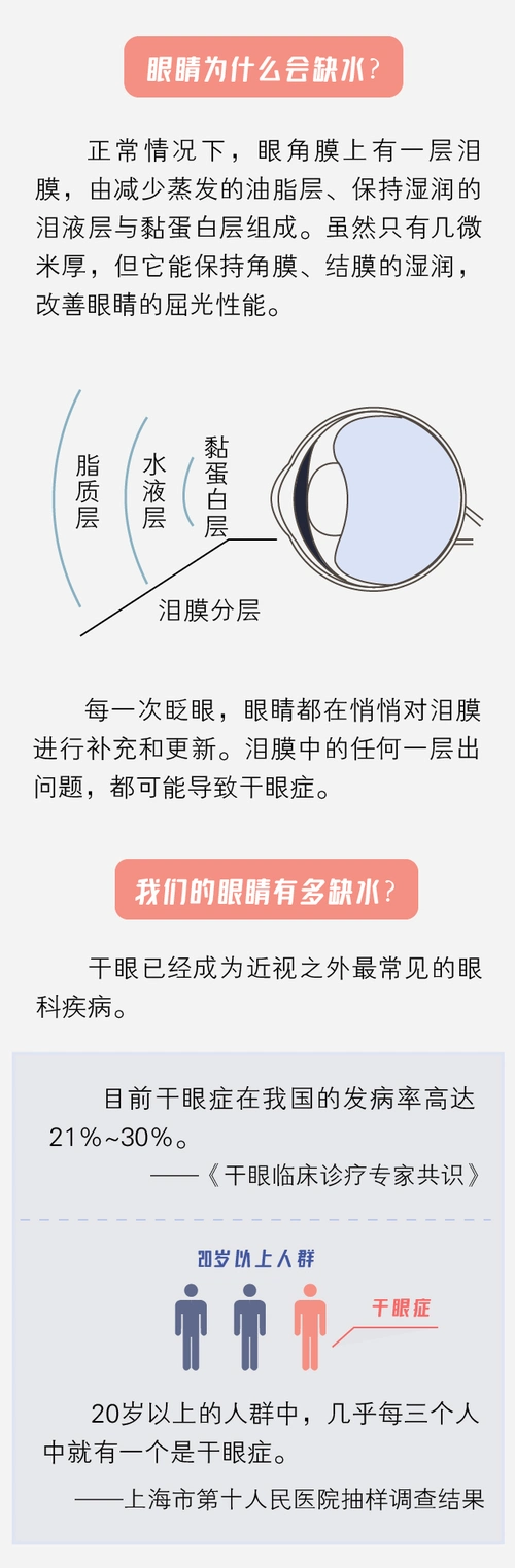 干眼症有哪些症状如何预防和治疗