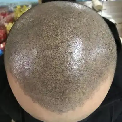 发量少的男生想要纹头发无锡纹头发就来无锡远航纹发