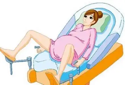 生孩子图片顺产图