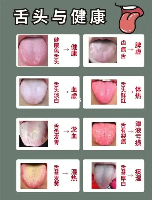 你的舌苔怎么了?