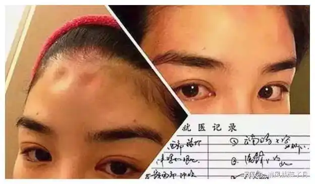 而黄奕无奈晒出了自己被家暴的照片,可以看出黄奕经历了什么痛苦.