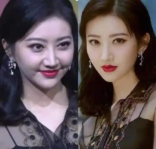 整容后遗症显现景甜发福显老生图精修差距大越长越像唐一菲