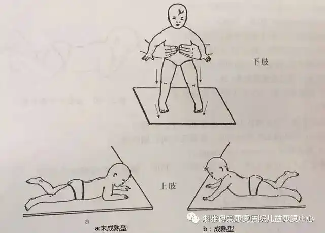 婴儿幼原始反射发育情况反映神经系统的发育水平