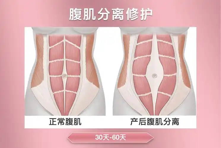 盆底肌腹直肌修复盆骨前倾经典金黑机构艾熏骨盆腹肌盆底减脂日本腰腹