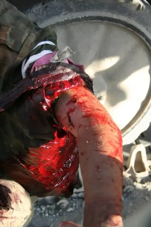 战地实拍:俄罗斯--格鲁吉亚残酷的战争