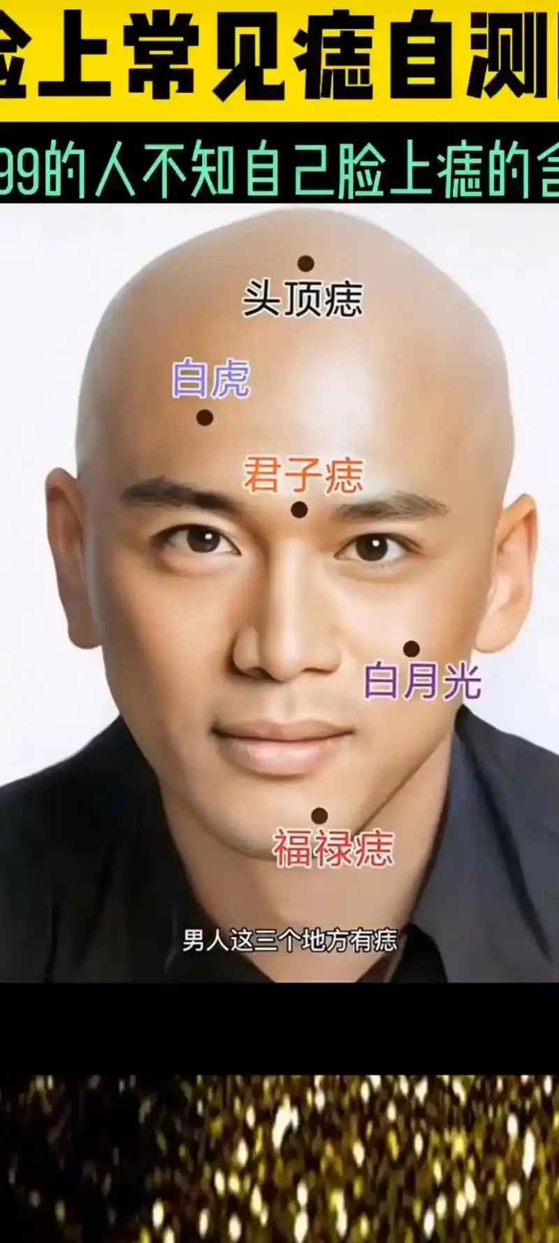 经验分享 #痣的含义 - 抖音