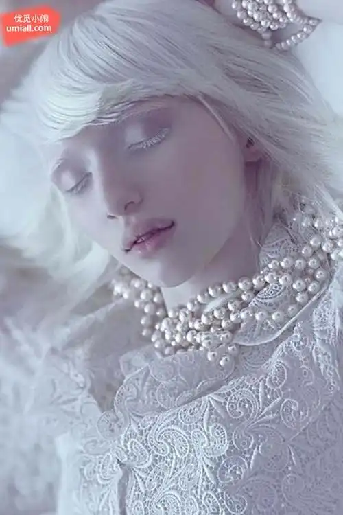 少女因白化症遭歧视,但她用这被歧视的外表惊艳了