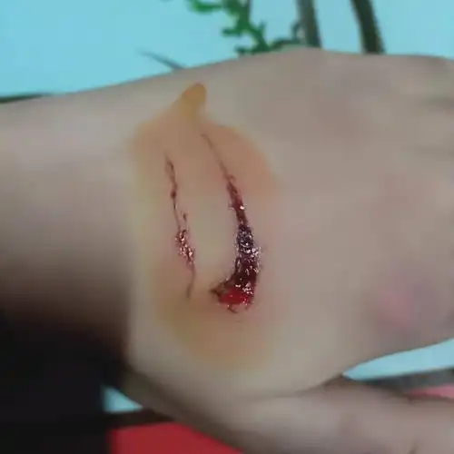 手上被门夹了连皮带肉都没了现在结疤了伤口也变小了我一直在用碘伏