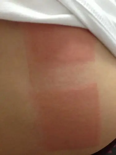 腰扭到了,昨天去药店买的膏药,刚贴的时候就有种火辣辣的感觉,后来