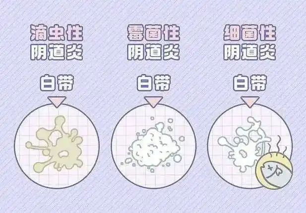 包括盆腔炎宫颈炎阴道炎等,会出现外阴瘙痒白带异常阴道分泌物增多