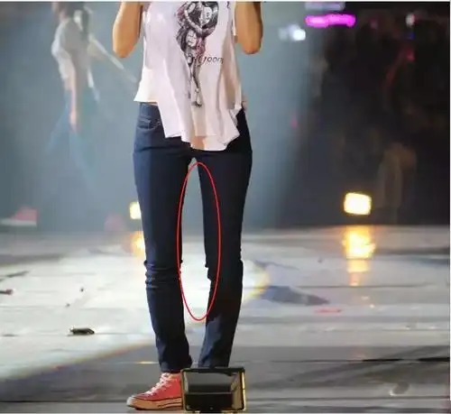 原创祖传的o型腿有救了