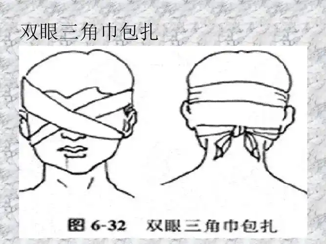 第16页 (共33页,当前第16页) 你可能喜欢 三角巾包扎法 动物咬伤 常见