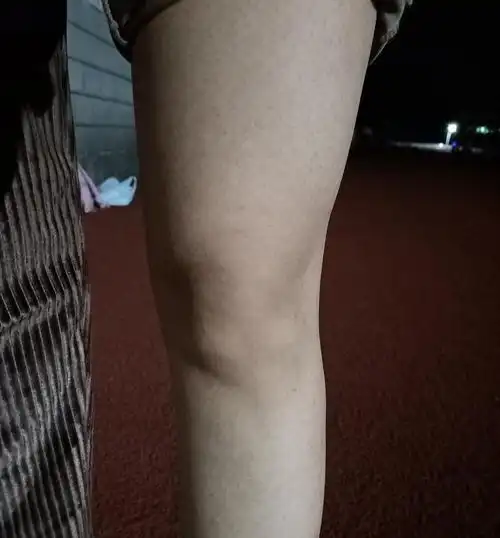 有没有大腿肌肉外翻股四头肌发达的姐妹啊