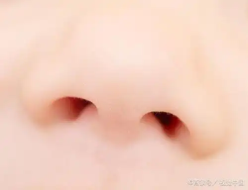 鼻梁低,因鼻骨软而易弯,个别的宝宝还可见歪斜,但随着发育以后不会留