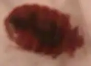 在床上发现的 请问是什么虫子