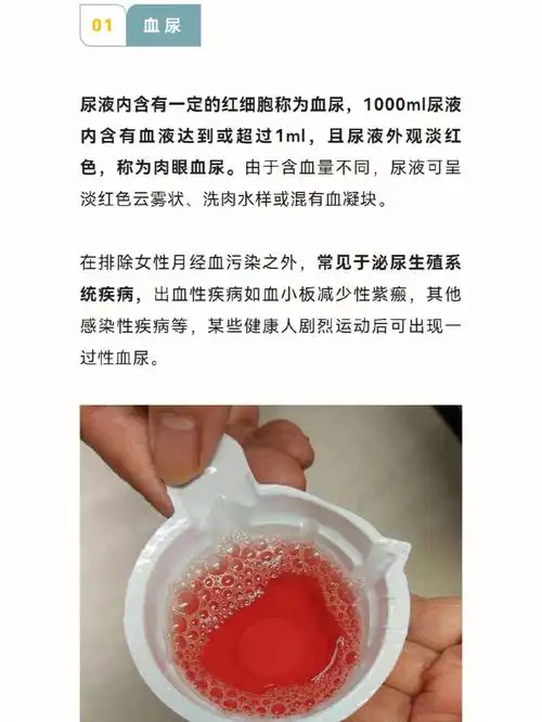 各种颜色尿液形成汇总1