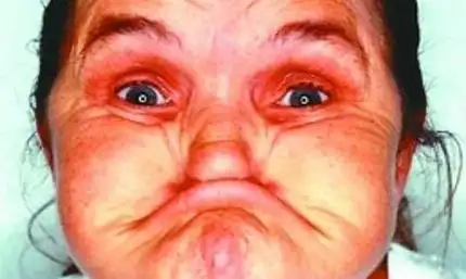 世界上最丑的人丑男人都有两任老婆八个孩子