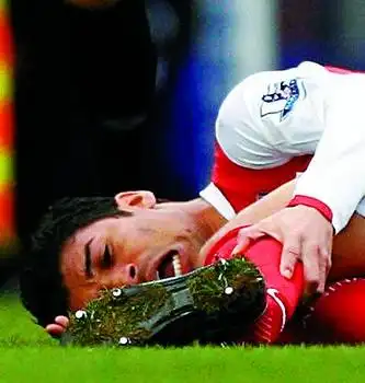 阿森纳前锋恐怖断腿