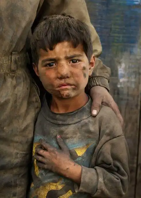 非洲儿童有一部分处於贫困线以下,他们每天的娱乐就是与大