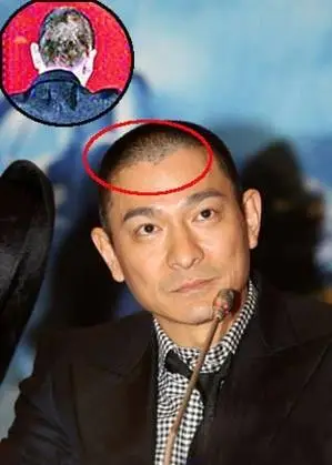 刘德华2011演唱会备战压力大导致严重脱发!