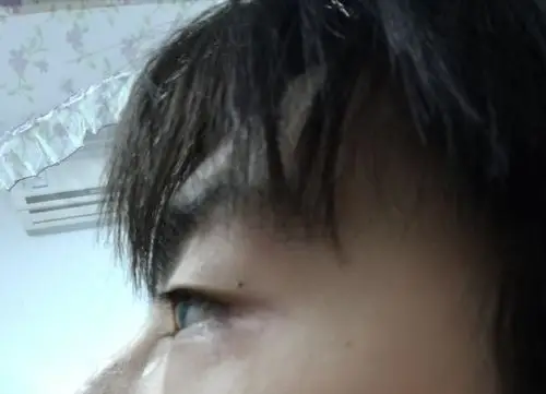 这是我的侧眼照,麻烦大家看看这眼睛嫌不嫌凸,谢了