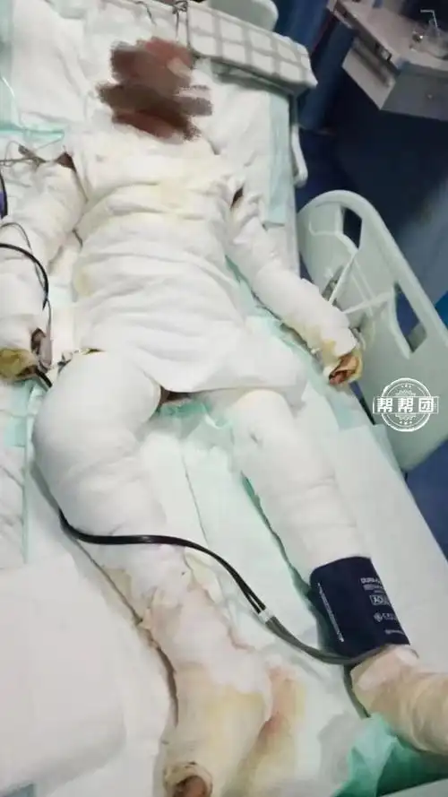 儿妈妈用嘴的父包满全身亲躺在i里,型告先救纱布诉女-国家栋梁网