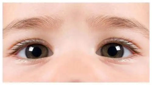 宝宝经常揉眼睛家长要引起重视可能是这四种情况